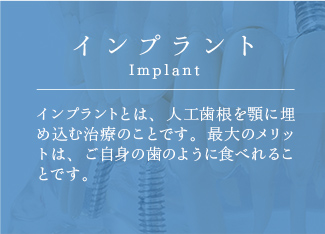 インプラント Implant