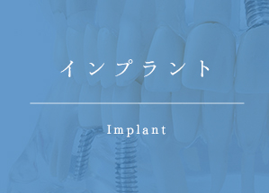 インプラント Implant